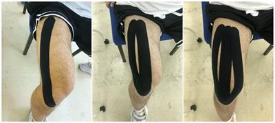 Short-term effects of kinesiology taping on static and dynamic balance in healthy subjects